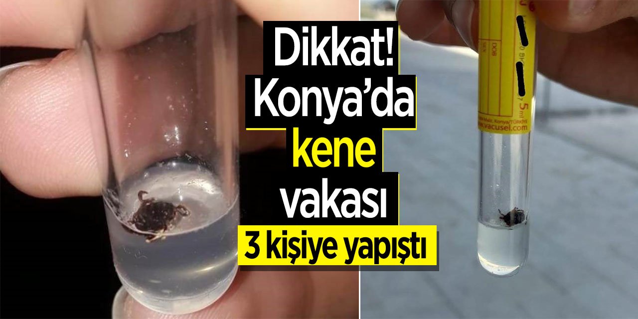 Konyalılar aman dikkat! Konya'da kene vakası 3 kişiye yapıştı