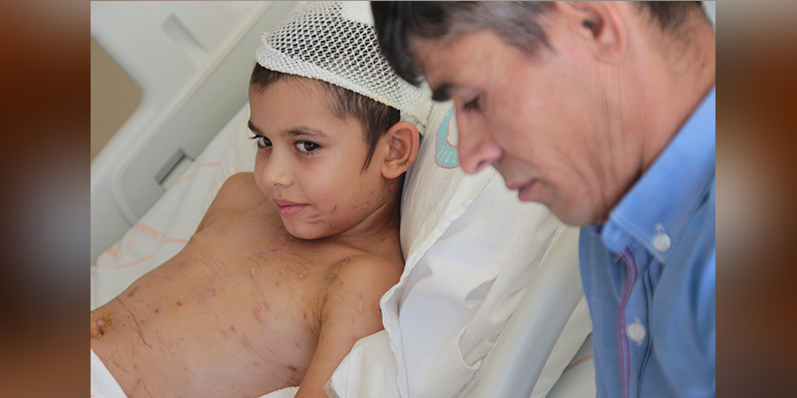 Sahipsiz köpeklerin saldırdığı küçük Umut 24 gün sonra taburcu edildi