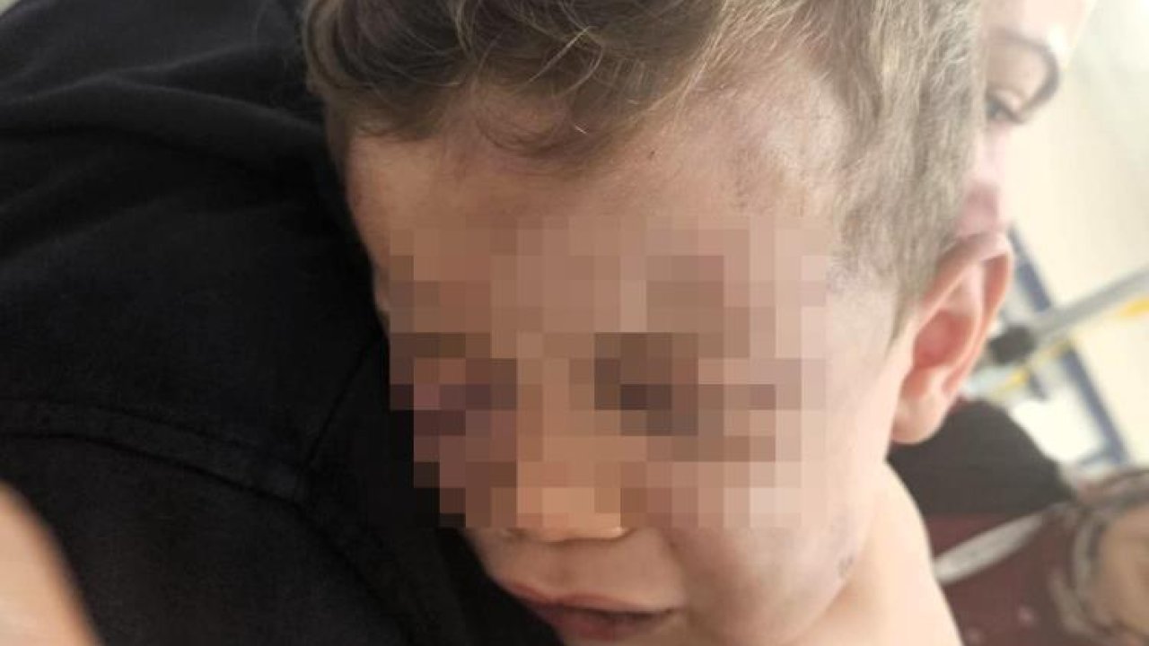 Vahşeti yaşayan 2 yaşındaki bebek hastanelik oldu!