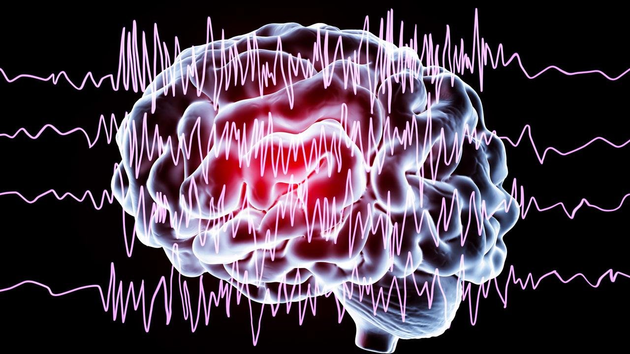 Epilepsi kontrol altına alınabilir mi? Uzmanından açıklama Düzenli rutin, tedavi başarısını artırıyor