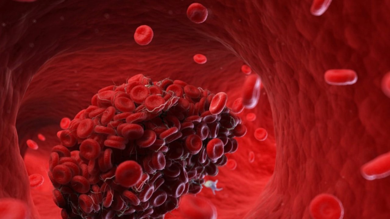 Aralıklı oruç kalp krizi riskini azaltıyor! Yeni araştırmadan dikkat çeken sonuçlar