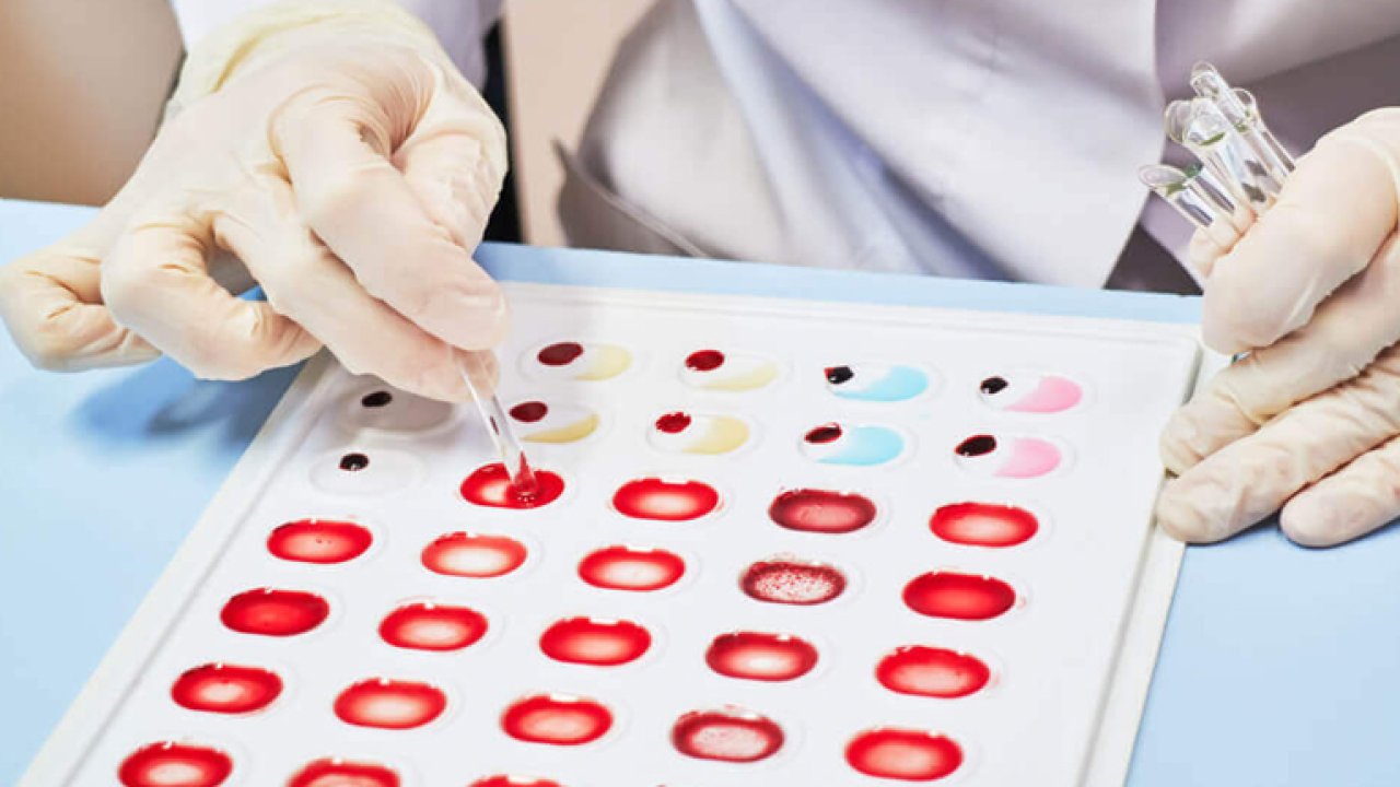 En zeki insanlar bu kan grubuna sahip! Bilim dünyasını şaşırtan sonuç!