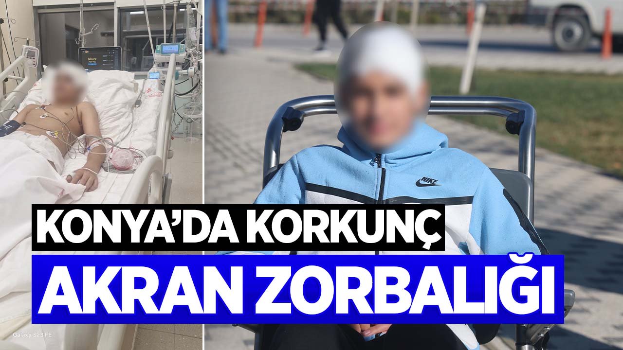 Konya'da akran zorbalığı dehşeti: 13 yaşındaki çocuğun kafatası titanyum parçalarıyla yeniden oluşturuldu