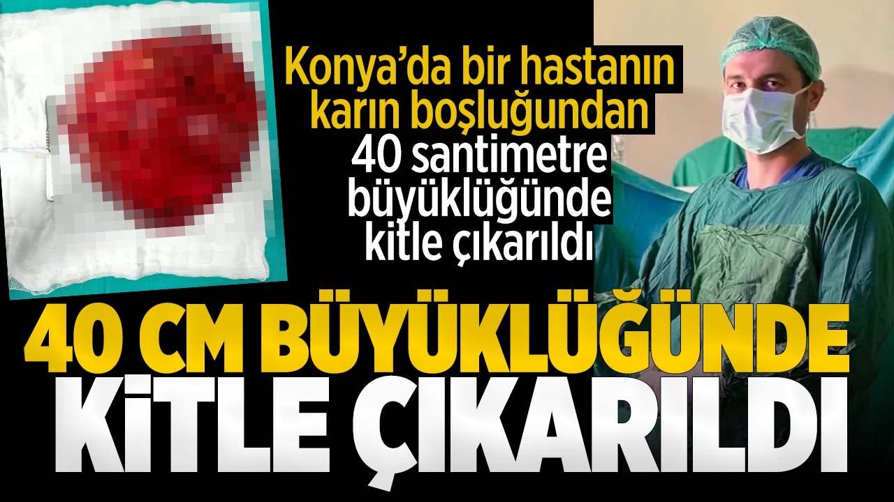 Konya'da bir hastanın karın boşluğundan 40 santimetre büyüklüğünde kitle çıkarıldı