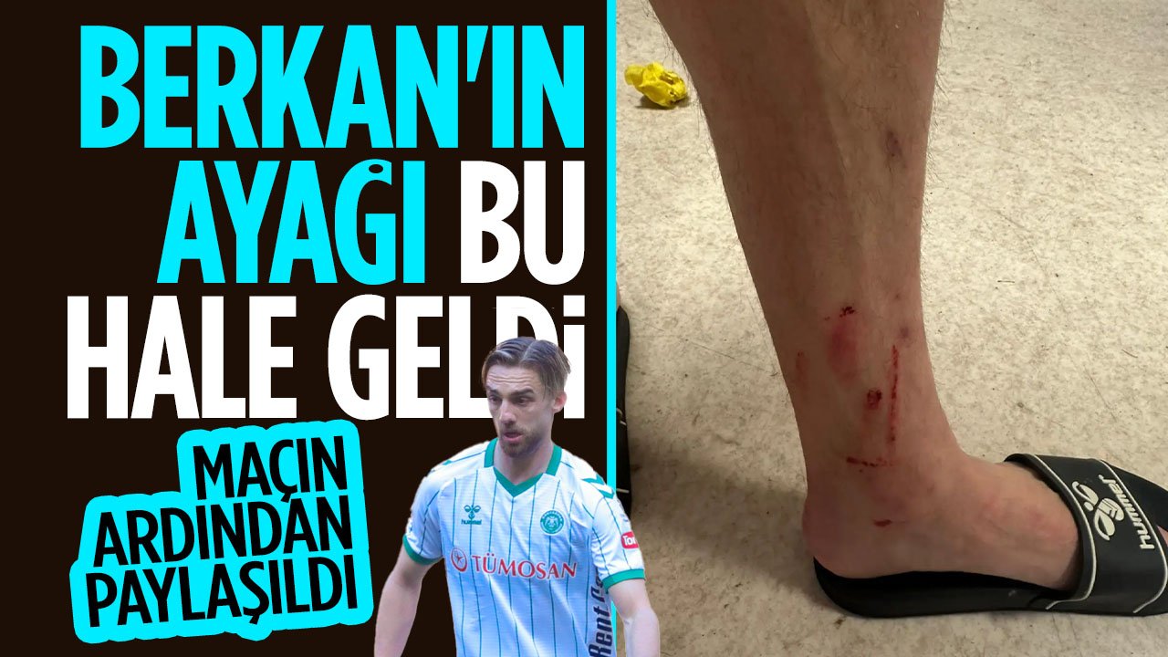 Konyasporlular tepki gösterdi: Maçtan sonra Konyasporlu oyuncunun ayağı kanadı