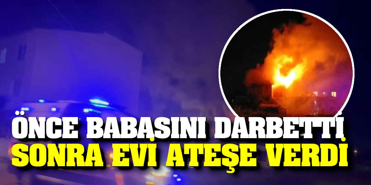 Önce Babasını Darbetti Sonra Evi Ateşe Verdi