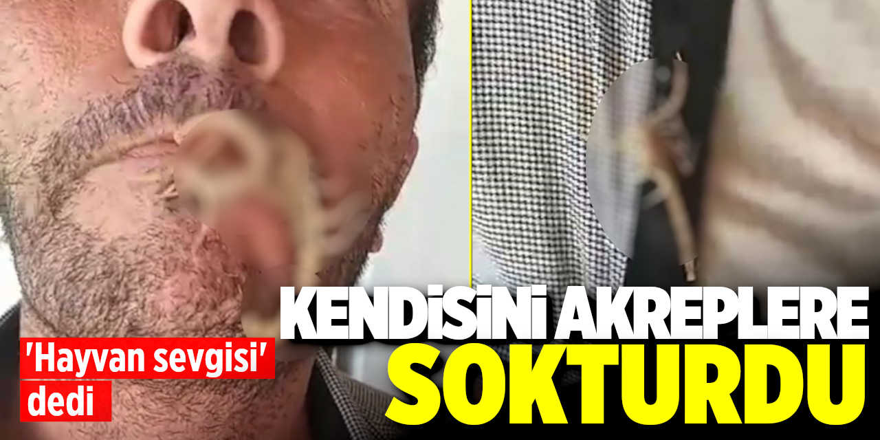Kendisini akreplere sokturan adam: 'Hayvan sevgisi' dedi