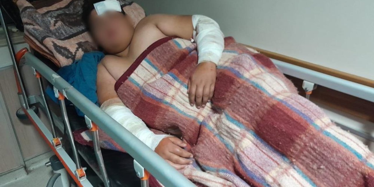 Konya'da köpeklerin kovaladığı çocuk bisikletten düşüp yaralandı